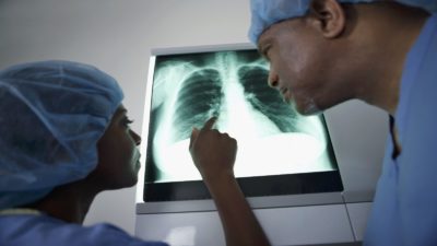 Two doctors having a discussion about an x-ray of a human lung