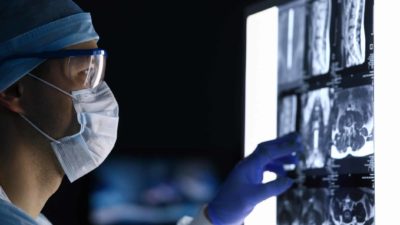 male wearing face mask reviewing medical scans on light box