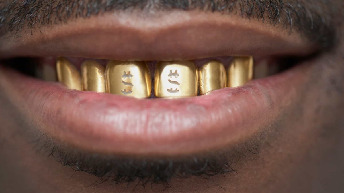 a smile from a man with a full set of gold teeth with dollar signs embossed on them.