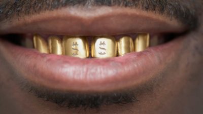 a smile from a man with a full set of gold teeth with dollar signs embossed on them.